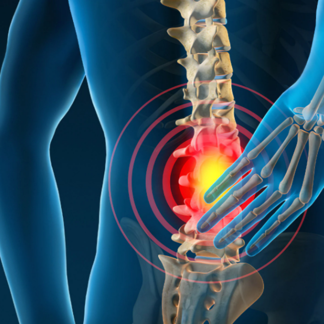 The 3 main causes of lower back pain, & how to start to manage your pain